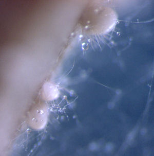 Microscopia e........MICRO funghi (muffe)